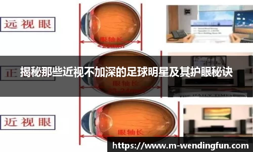 揭秘那些近视不加深的足球明星及其护眼秘诀